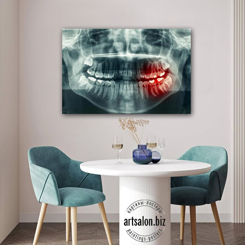 dental-art-60x90-cm
Цена зависит от размера, cовременная картина-Европанель, супер модный стиль, Печать, покрытие матовый защитный лак, можно протирать (любая печать без лака, со временем выцветает) Заказ принимается после согласования всех детапей, размер, цена, предоплата. Оплата в Узбекистане в сумах по Гос. курсу, Visa, Российские Рубли. заказ можно прислать в Telegram, WhatsApp +998 90 975-10-05
21x30см 4$.....
42х30cm 7$.....
60х40cm15$.....
60х60cm15$.....
50х70cm17$.....
60х80cm 20$.....
60х90cm 20$.....
60x100cm 25$.....