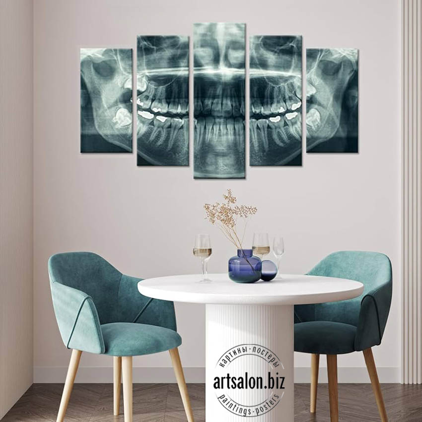 modern-dental-art-modul-5-set
SENA ZAVISIT OT RAZMERA PO SHIRINE
