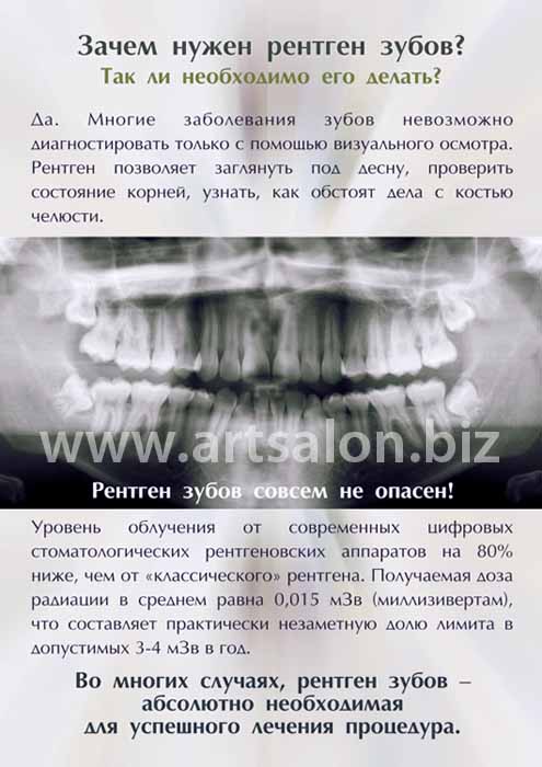 zachem-nuzhen-rentgen-zubov